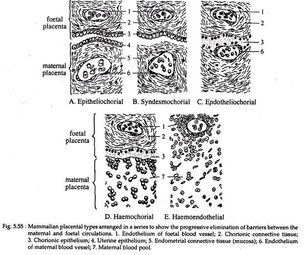 types of placenta ppt