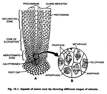 Squash of onion root tip showing different stages of mitosis