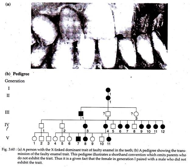 X-Linked Dominant Trait and Transmission of the Faulty Enamel Trait