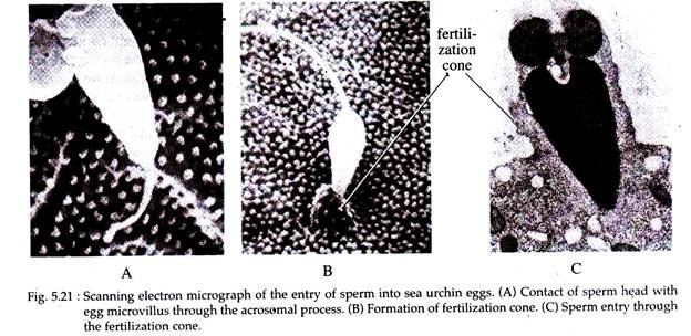 Scanning Electron Micrograph