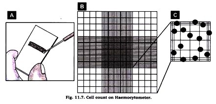Cell count on haemocytometer