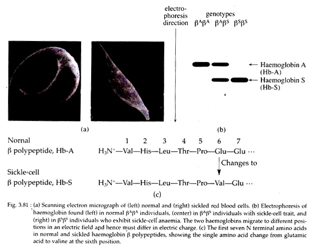 Electron Micrograph, Electrophoresis of Haemoglobin Found and First Seven N Terminal