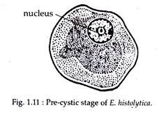 Pre-Cystic Stage 