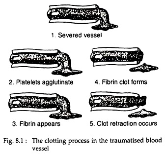 Clotting Process in the Traumatised Blood Vessel