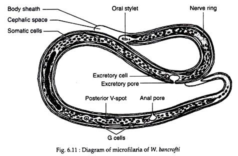 Microfilaria of W.bancrofti