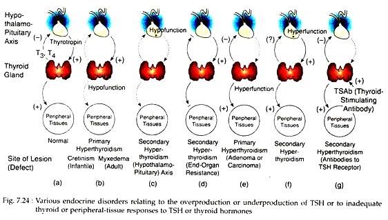 Various Endocrine Disorders