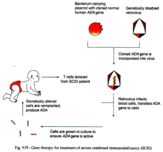 Gene Therapy for Treatment of Severe Combined Immunodeficiency