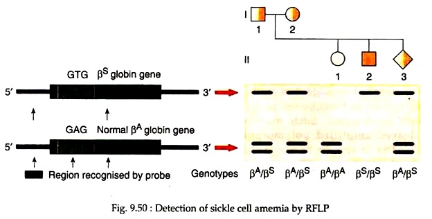 Detection of Sickle Cell Amenia by RFLP