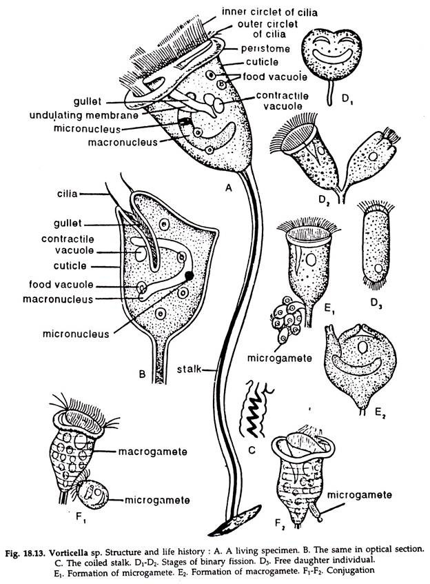 Vorticella sp.