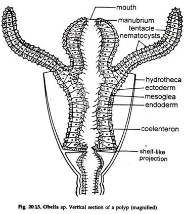 Obelia sp. Vertical Section of a Polyp
