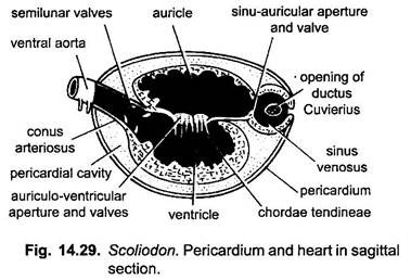 Pericardium and Heart in Sagittal Section