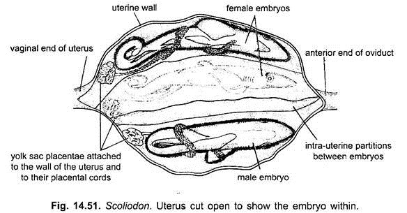 Uterus Cut Open to Show the Embryo Within